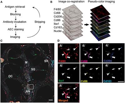 Multiplex immunohistochemistry reveals cochlear macrophage heterogeneity and local auditory nerve inflammation in cisplatin-induced hearing loss